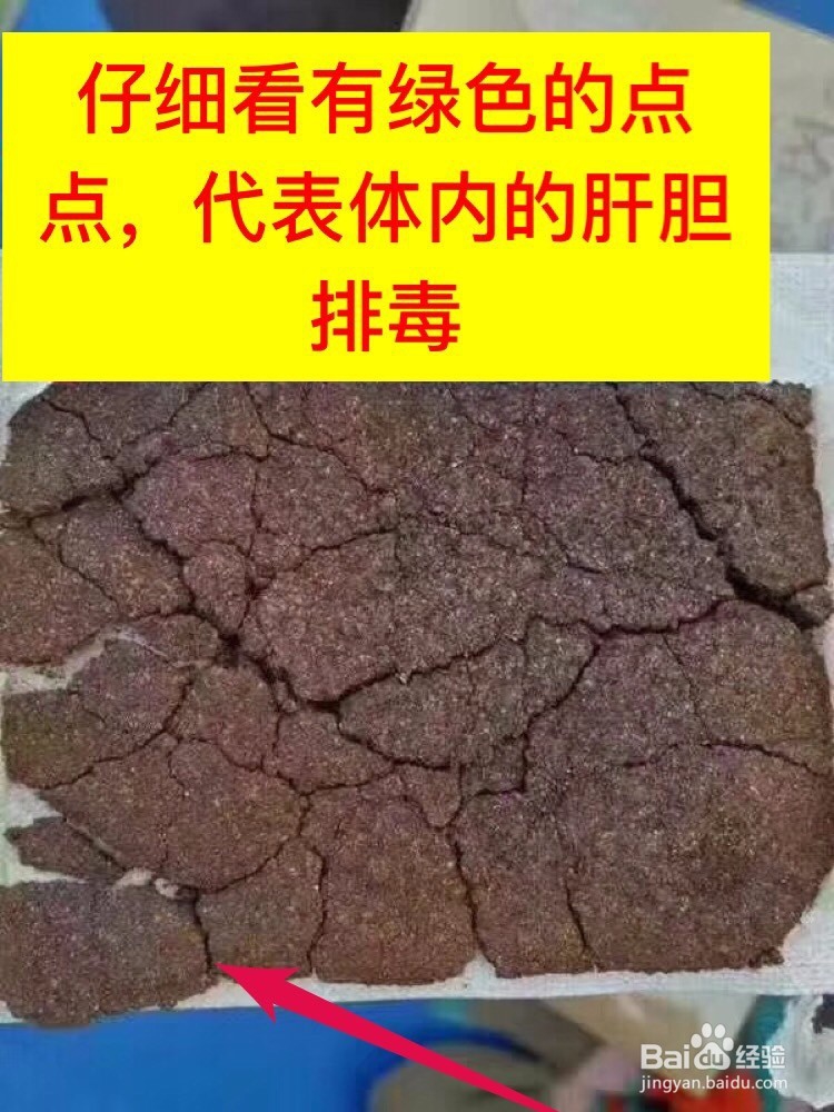 艾热灸使用后药包颜色对比