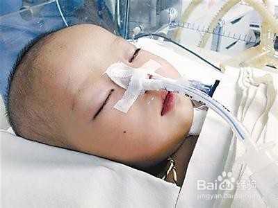 孩子冻伤后如何急救