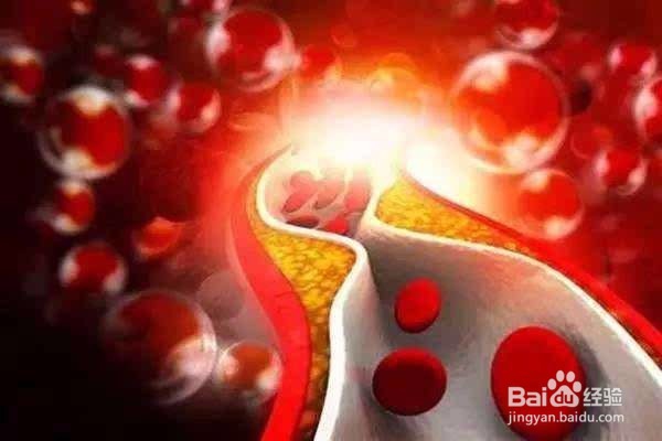 对付胆固醇的食物有哪些