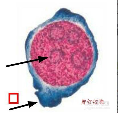 怎样辨认骨髓片子这是哪种细胞啊