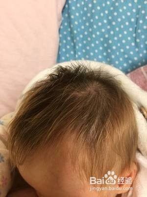 宝宝头发有点黄