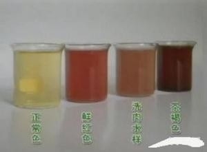 膀胱癌系列指南：[2]膀胱癌的症状及诊断方法