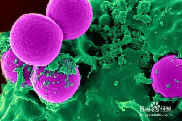 你不应该忽视7个白血病的重要症状