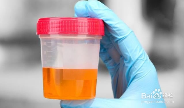 影响男性的最常见类型的癌症