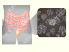 急性肠炎的症状