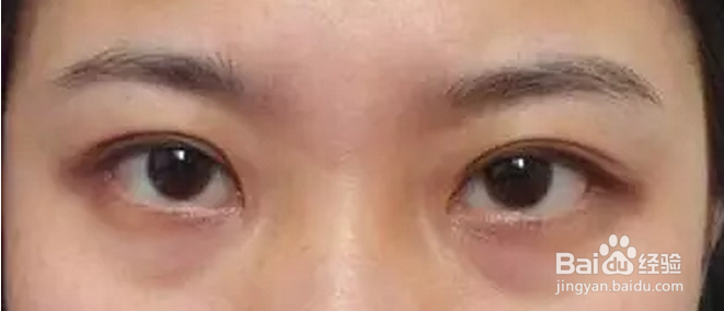 3分钟告别黑眼圈，