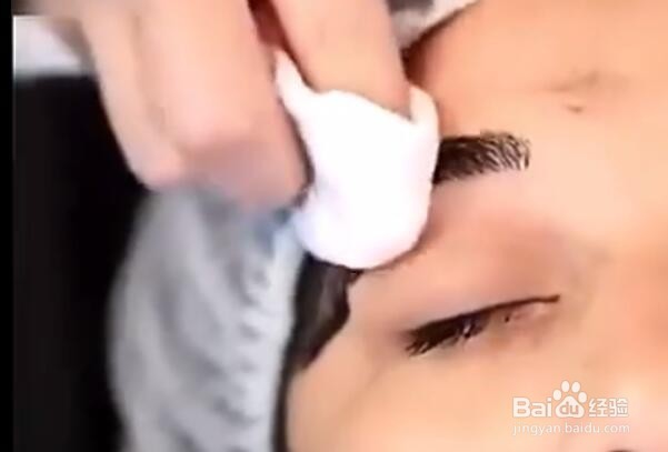 纹绣中途出血的预防及处理方法