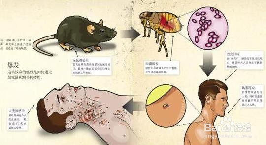 如何预防鼠疫