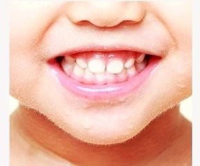 <b>小孩可以怎么防止蛀牙</b>