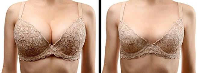 女性荷尔蒙不平衡的表现