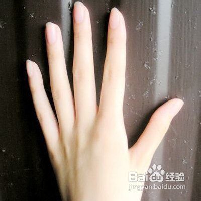 手指关节发黑 肿大 洗不掉