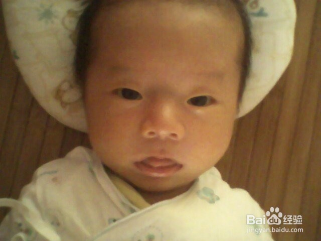 应对宝宝黄疸,妈妈你应该怎么办?