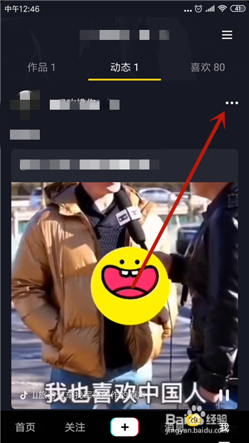 抖音转发的视频怎么删除