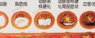 养成吃早餐的好处