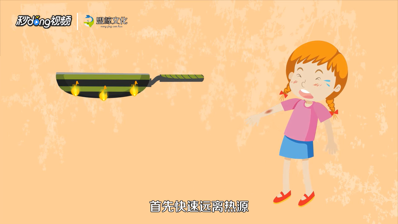 烫伤怎么处理