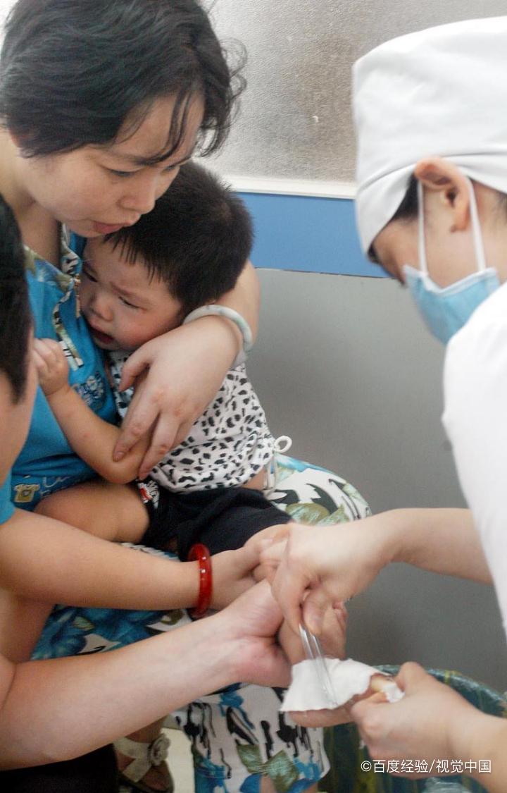 烫伤处理的正确方法是什么