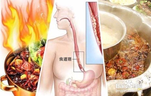 中年人容易患什么病