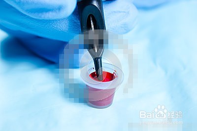 纹身墨水弄手上怎么清洗呢?