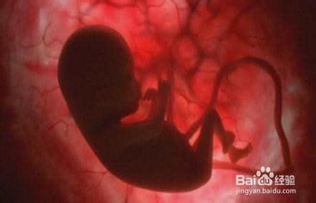 四维彩超孕检报告怎么看