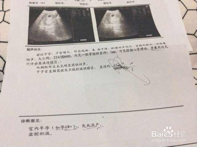 去医院生孩子前应该准备哪些证件？