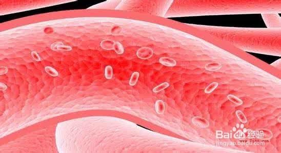 血管堵, 疾病生! 疏通血管就用这5招