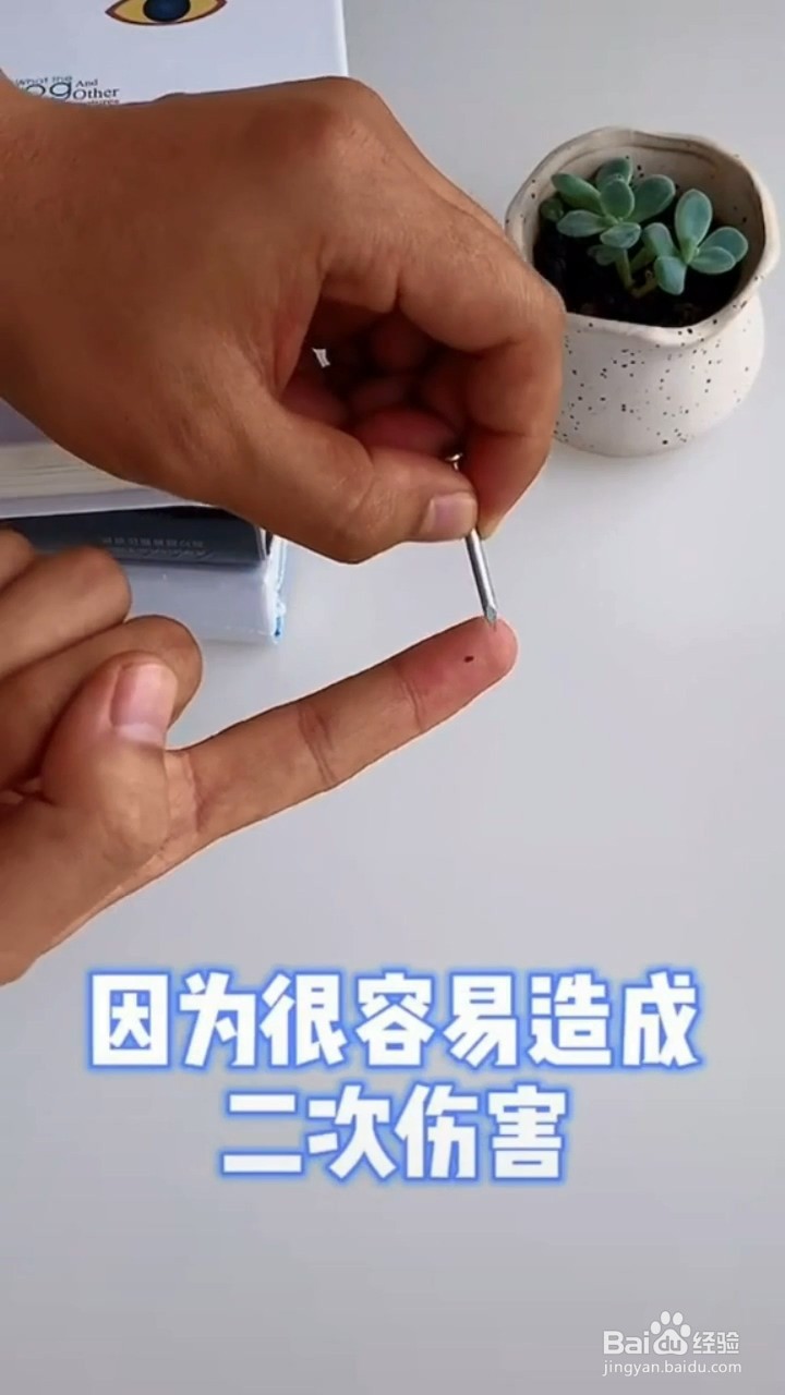 手指扎刺了怎么办