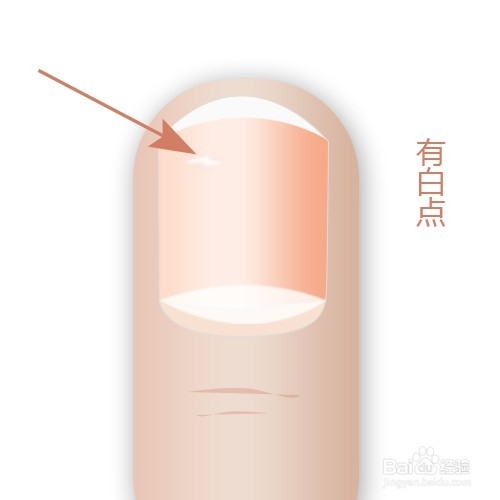 通过指甲看身体状况