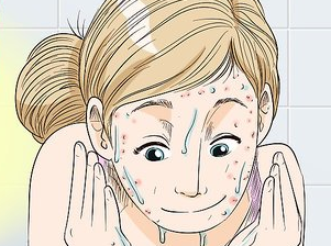 如何快速消除痘痘,使你的脸更干净