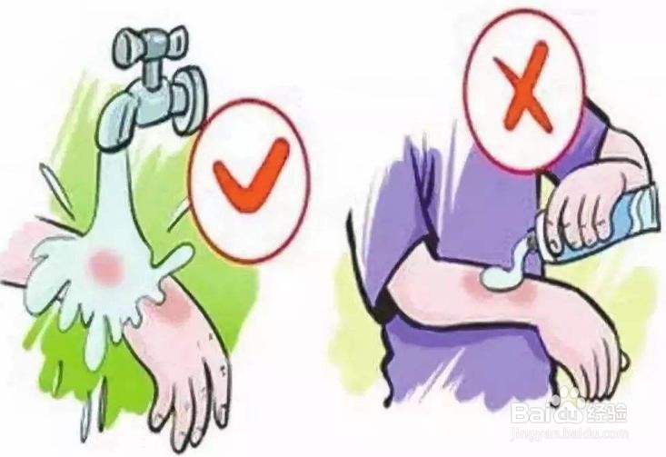 老人烫伤的处理方法