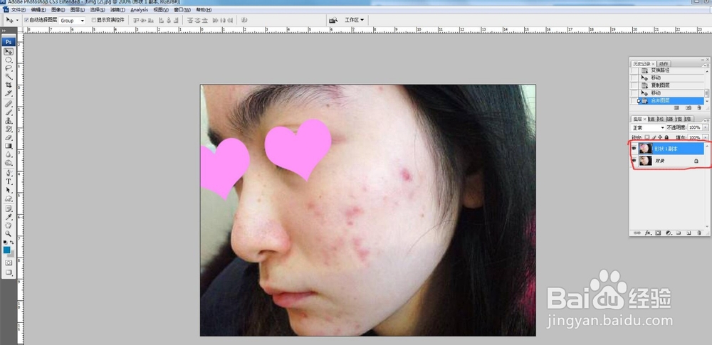 PS怎么去掉照片脸上的痘印斑点