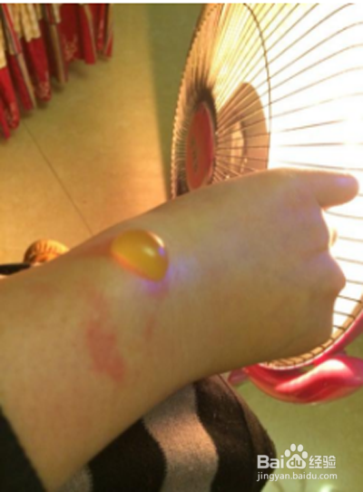 手被石锅烫了怎么处理
