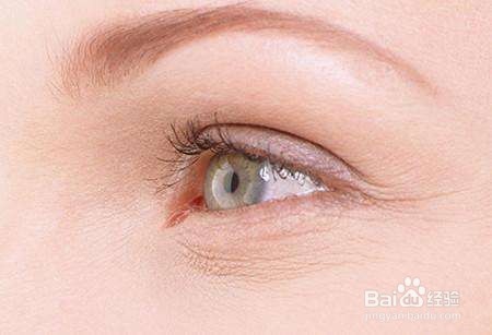 怎样消除眼角皱纹