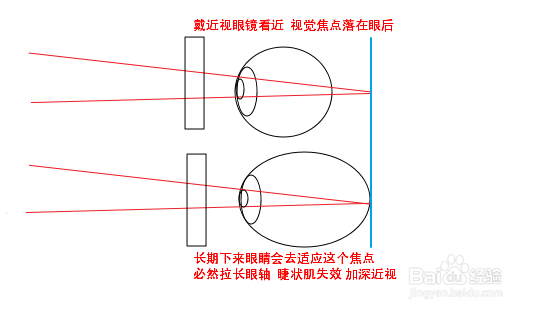 近视自我训练恢复法