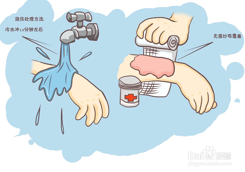 遇到烧烫伤怎样先现场救助