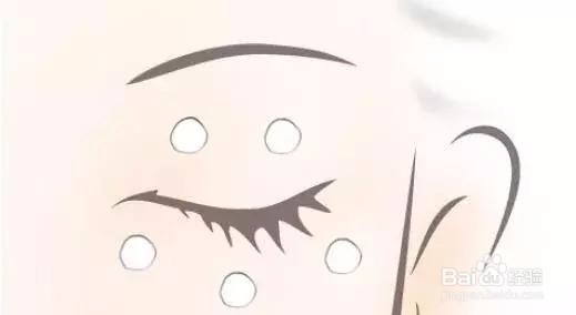 脂肪粒的产生原因和去除方法