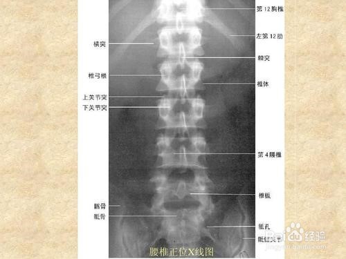 X射线是怎么成像的