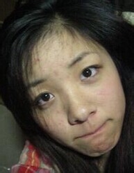 生活中祛痘印的小窍门