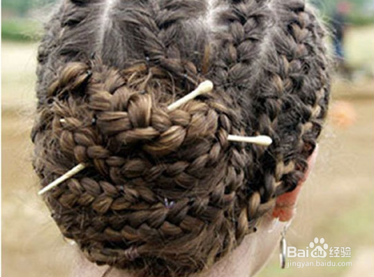 掉发严重怎么办?