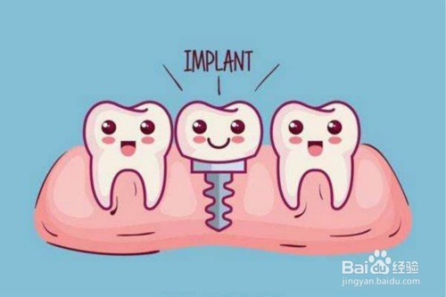 合肥市口腔医院 种牙多少钱?贵不贵