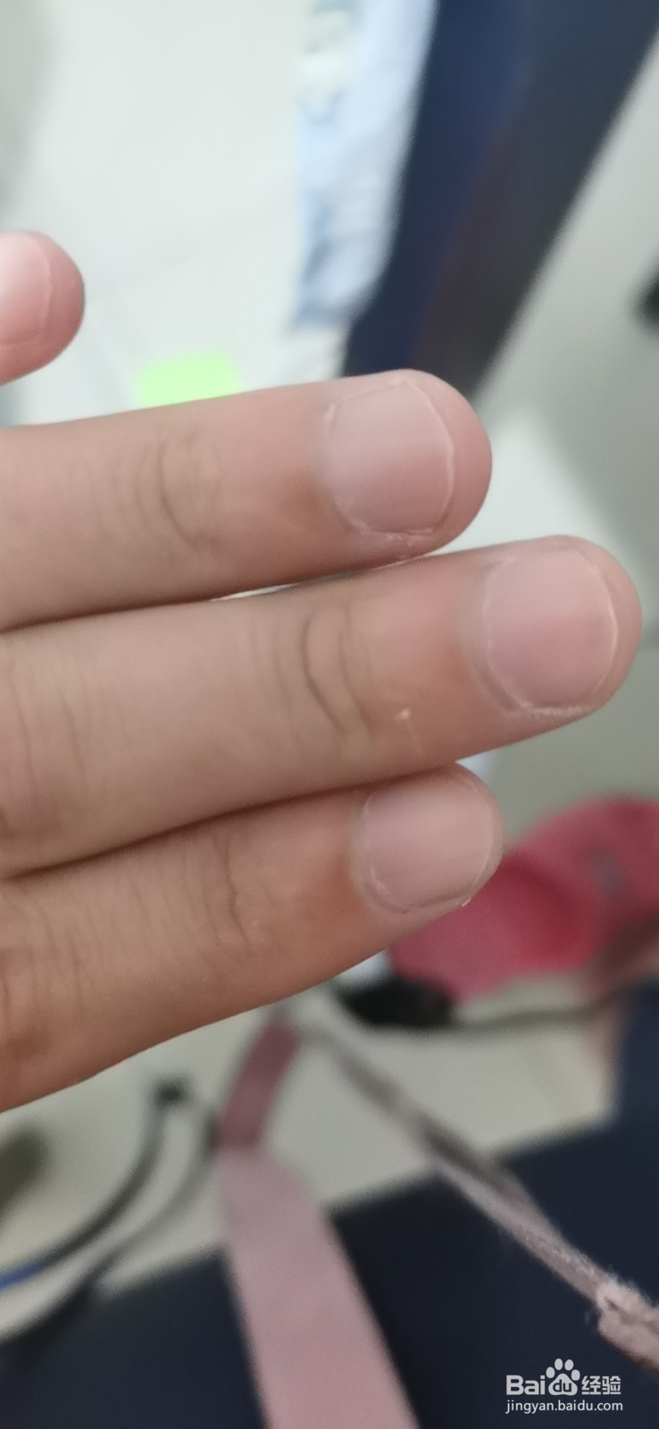 教你如何处理一般暑气。