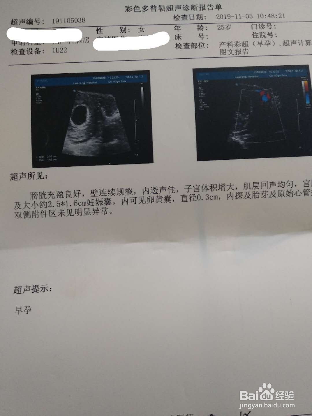 孕期产检内容及对应的时间表