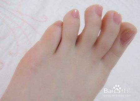 脚臭是什么原因引起的？教你5个解决脚臭的方法