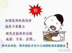 烧伤怎么处理