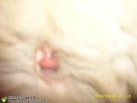 长时间便秘的原因