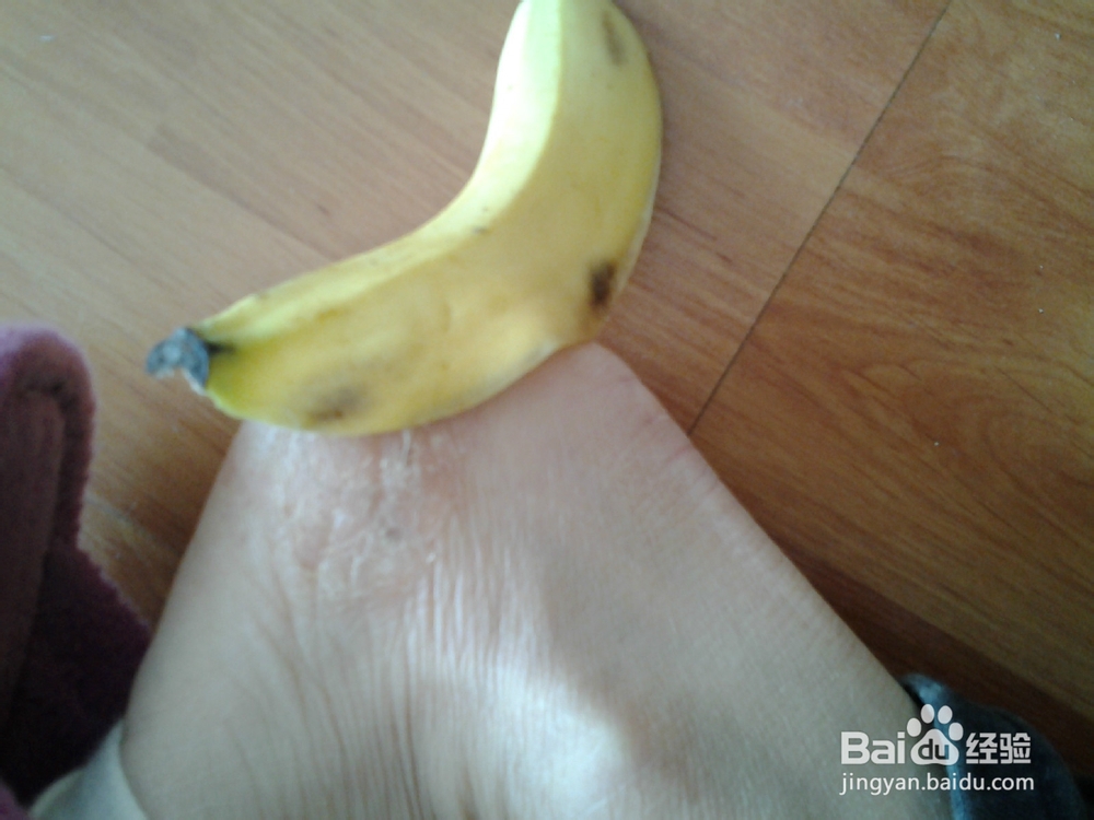 香蕉皮巧治皲裂
