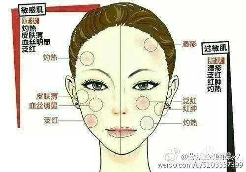 敏感肌肤应该怎么护理？