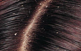 怎样根据头部判断身体所需补充的营养