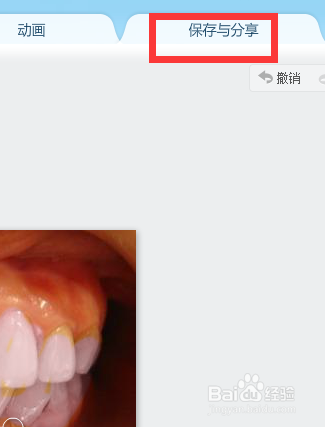 如何使用美图秀秀美白牙齿