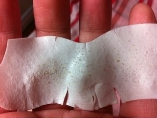 怎么去黑头？我有办法！！