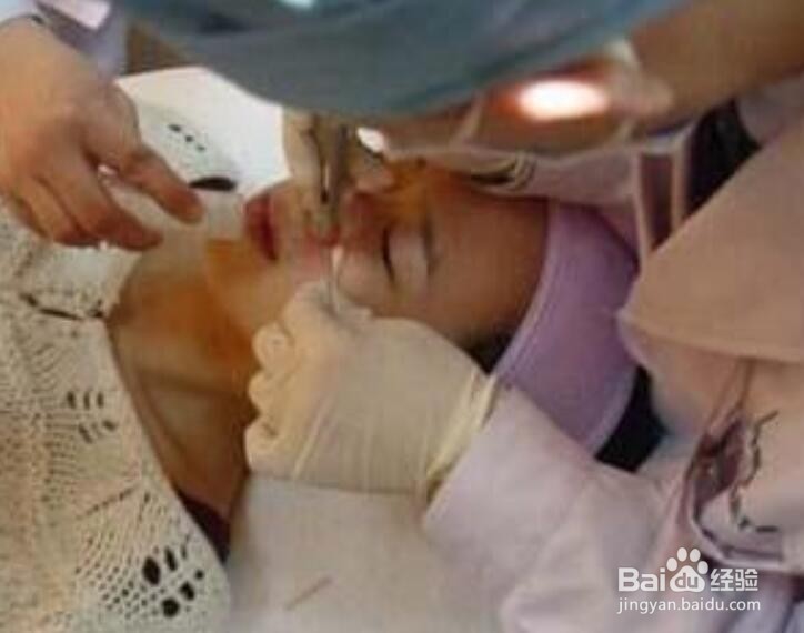 为什么痦子不能随便去掉？有什么危险？